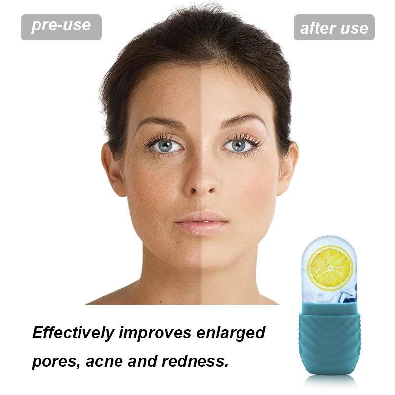 Ice Facial Roller for Glowing Skin – Reduce Puffiness & Tighten Pores